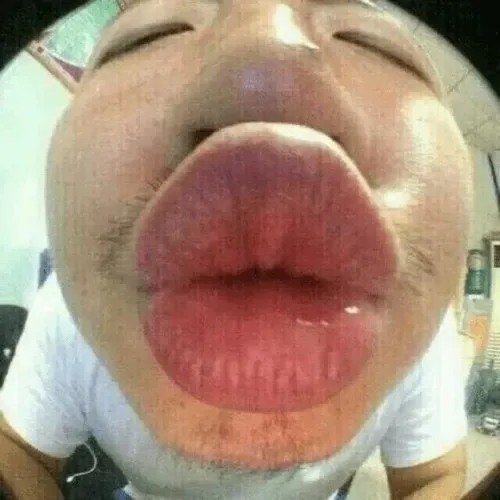 meme hôn bựa