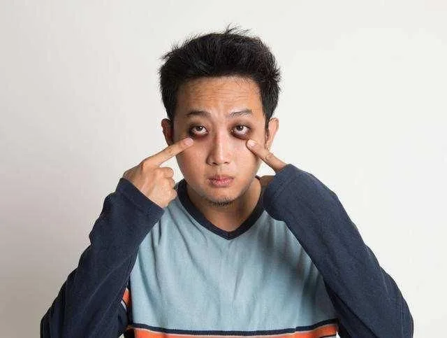 hình ảnh mắt thâm hài hước