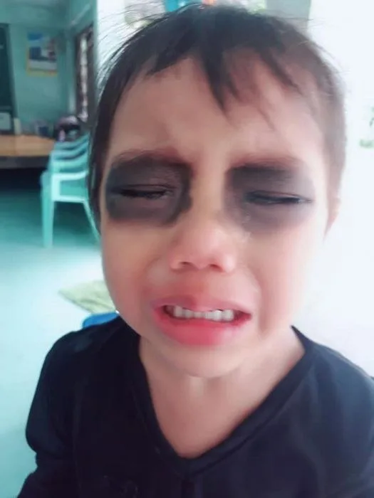 hình ảnh mắt thâm hài hước