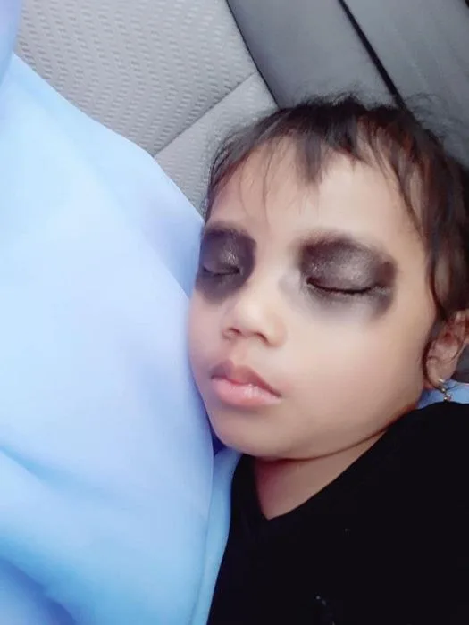 hình ảnh mắt thâm hài hước
