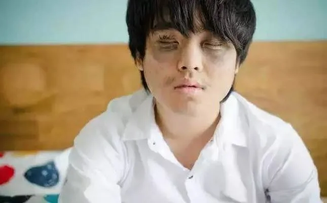 hình ảnh mắt thâm hài hước